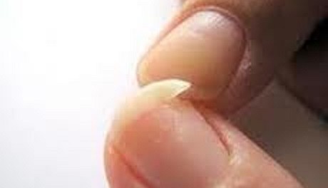 remedios uñas frágiles