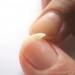 Remedios para fortalecer las uñas frágiles y quebradizas