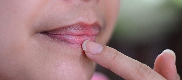 remedios para aclarar los labios