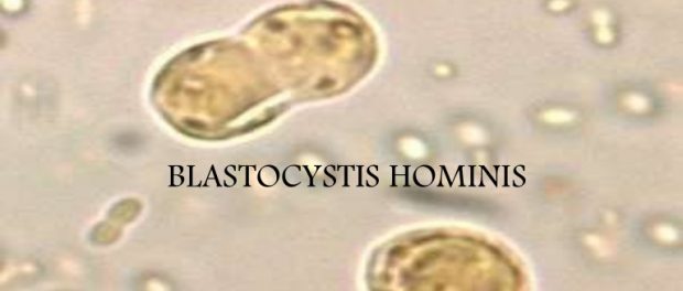 blastocystis hominis tratamiento casero