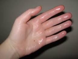 remedios manos sudorosas