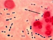 Enterococcus faecalis tratamiento natural