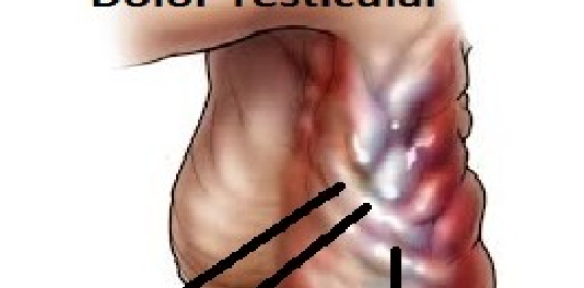 plantas medicinales para la varicocele