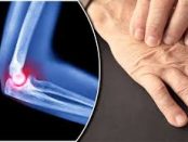 suplementos artritis