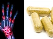 vitaminas y minerales para la artritis
