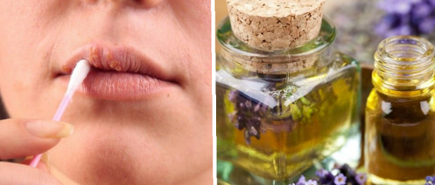 aceites esenciales para el herpes labial