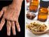 aceites esenciales para la artritis