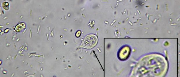 remedios giardiasis o giardia lamblia