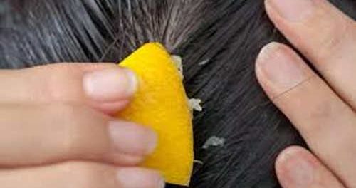 como usar el limón para el crecimiento de cabello