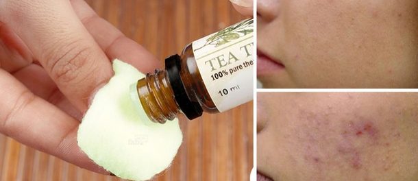 como aplicar el aceite del árbol del te