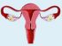remedios caseros para aumentar la progesterona