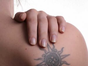 remedios para quitar tatuaje