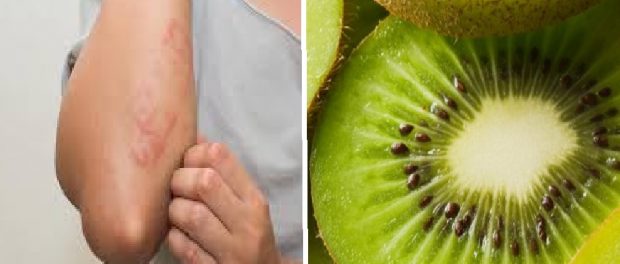 kiwi beneficios y contraindicaciones