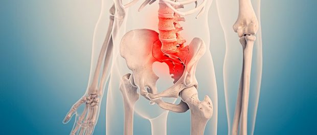 sacroileitis