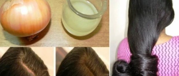 Propiedades de la cebolla para el cabello