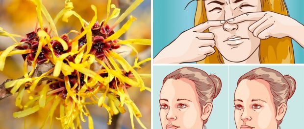 hamamelis propiedades y contraindicaciones